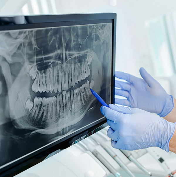 Dentist gesturing to an x ray of teeth