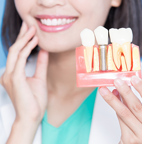 Smiling dentist holding a dental implant model