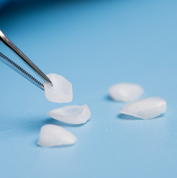 Tweezers picking up a veneer