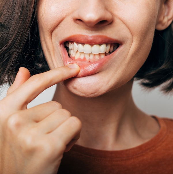 Woman pulling down her lower lip to expose her gums