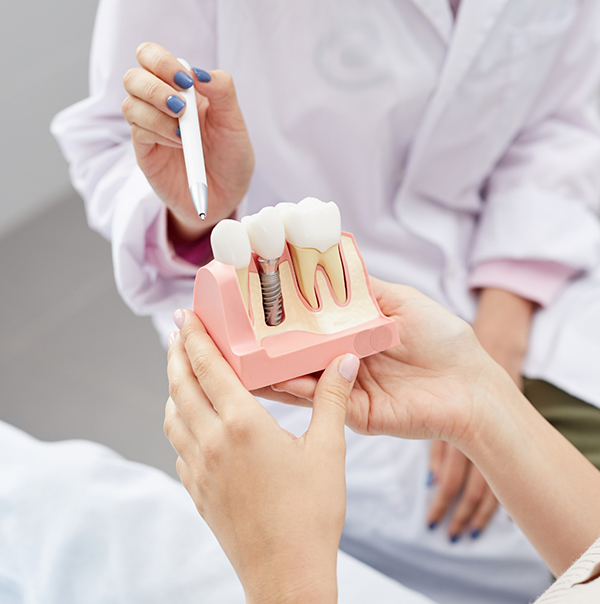 Dentist showing a model of a dental implant to a patient