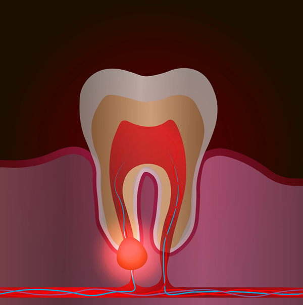 Illustration of the inner layers of a tooth with a bump near the roots