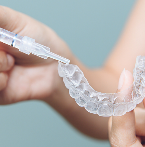 Person applying bleaching gel to a teeth whitening tray